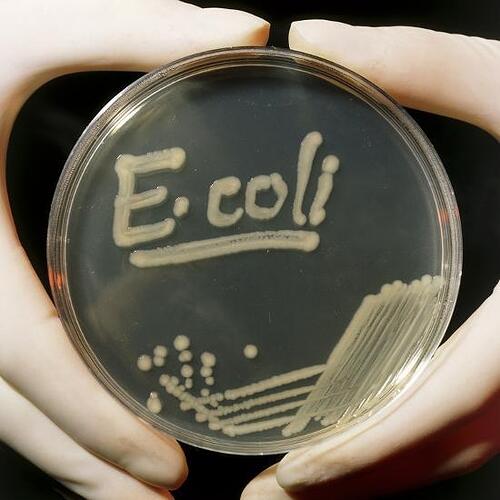 petri-dish-culture-of-e-coli-bacteria_u-L-PZF8XG0